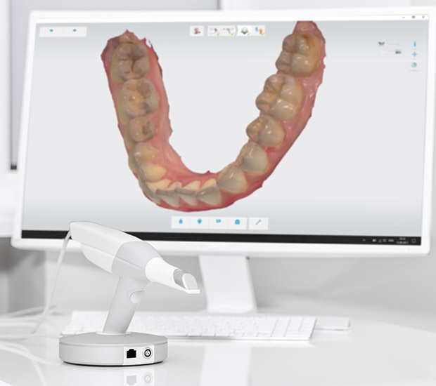 Altamonte Springs 3D Cone Beam and 3D Dental Scans