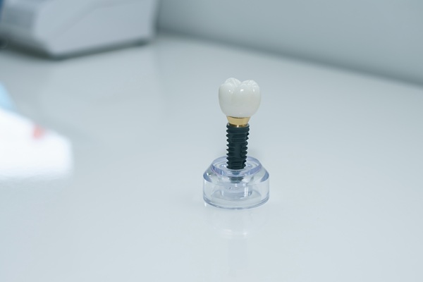 How Dental Implants Slow Down And Prevent Bone Loss