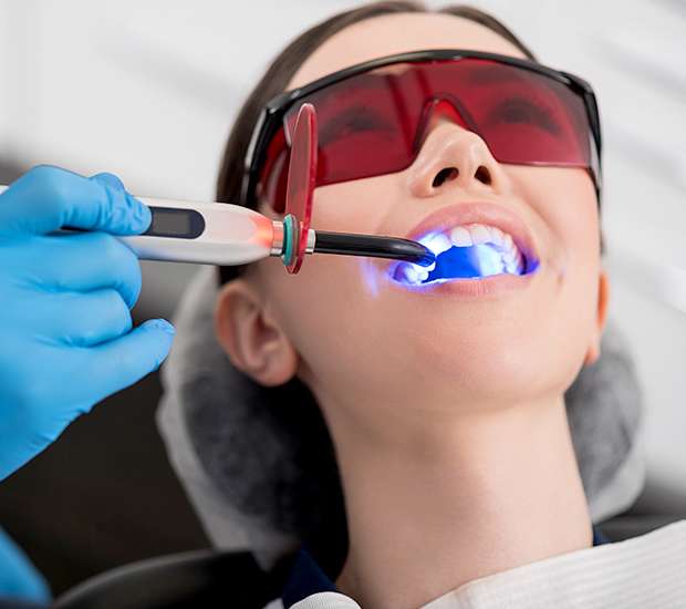 Altamonte Springs Professional Teeth Whitening